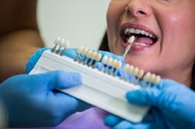Dental Check-Up & Teeth Cleaning: What It Costs and Where to Find a Clinic Near You