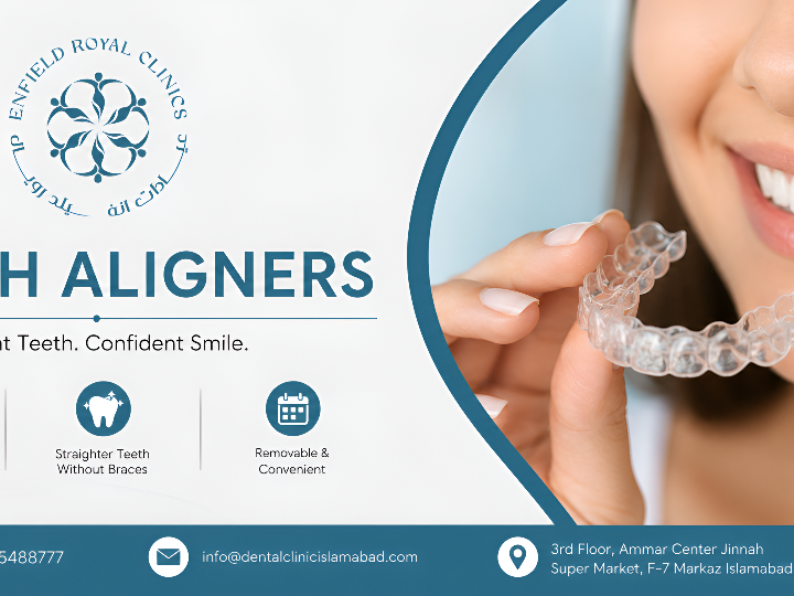 What to Know Before Choosing Teeth Aligners