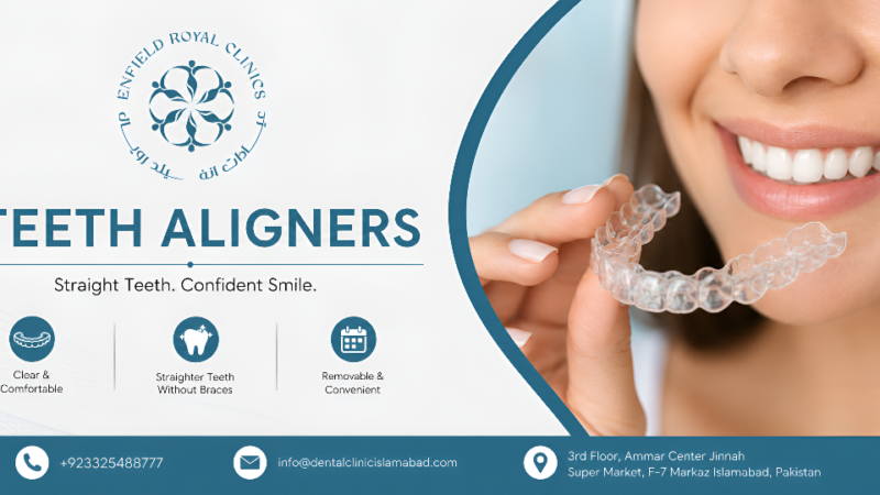 What to Know Before Choosing Teeth Aligners
