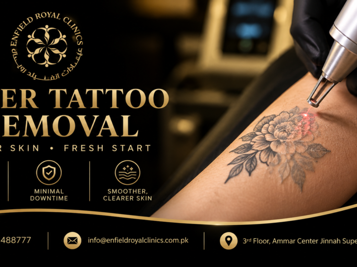 Does Tattoo Removal Help Fade Old Tattoos?