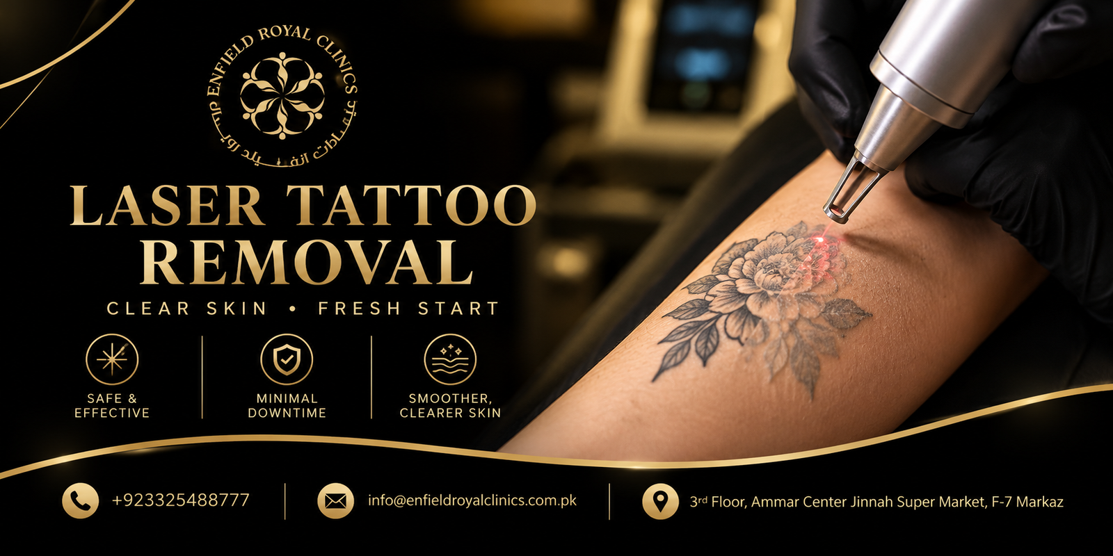 Does Tattoo Removal Help Fade Old Tattoos?